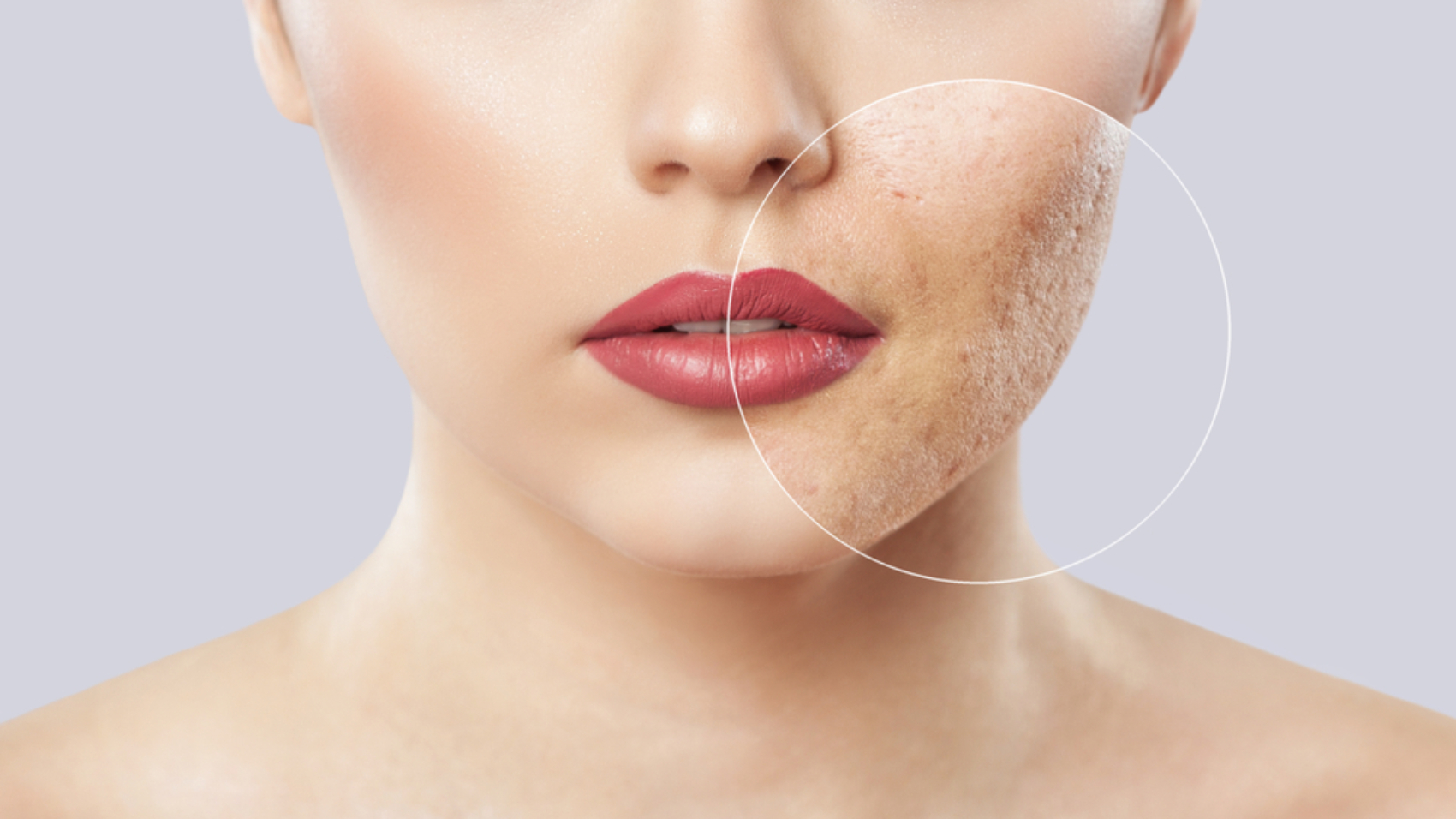 The Role of Dermatologists in Managing Chronic Skin Conditions