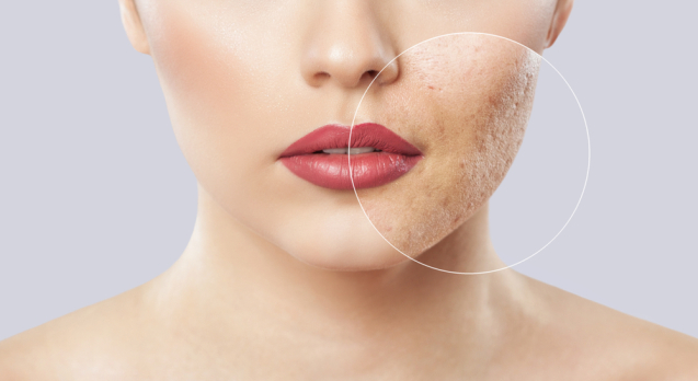 The Role of Dermatologists in Managing Chronic Skin Conditions